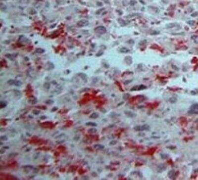 Immunohistochemistry-Paraffin: DC-SIGN/CD209 Antibody (102E11.06) [DDX0202P-100]