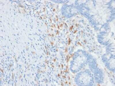 Immunohistochemistry-Paraffin: DC-SIGN/CD209 Antibody (C209/1781) [NBP2-53275]
