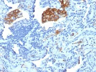 Immunohistochemistry-Paraffin: DC-SIGN/CD209 Antibody (C209/1781) [NBP2-53275]