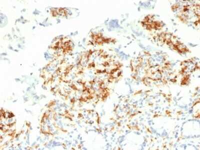 Immunohistochemistry-Paraffin: DC-SIGN/CD209 Antibody (C209/1781) [NBP2-53275]
