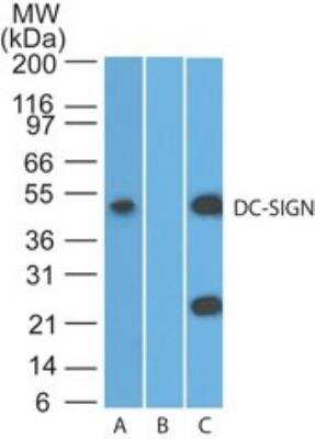 Western Blot: DC-SIGN/CD209 Antibody [NBP2-27408]