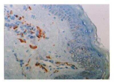 Immunohistochemistry: DC-SIGNR/CD299/CLEC4M Antibody (128G8) [DDX0201P-100]