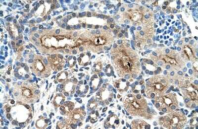 Immunohistochemistry-Paraffin: DC-SIGNR/CD299/CLEC4M Antibody [NBP1-59182]