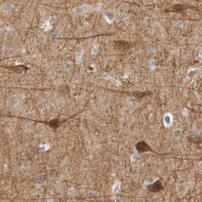 Immunohistochemistry-Paraffin: DCAF10 Antibody [NBP1-82090]