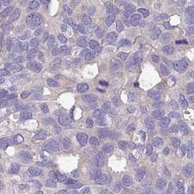 Immunohistochemistry-Paraffin: DCAF12L2 Antibody [NBP2-33544]