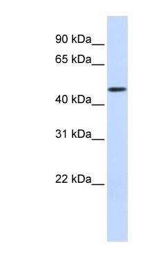 Western Blot: DCAF4 Antibody [NBP1-52862]