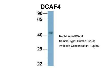 Western Blot: DCAF4 Antibody [NBP1-52862]