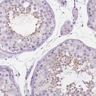 Immunohistochemistry-Paraffin: DCAF8L1 Antibody [NBP1-93435]