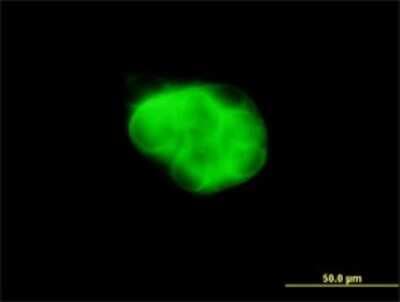 Immunocytochemistry/ Immunofluorescence: DCAKD Antibody (3E4) [H00079877-M02]