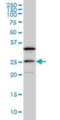 Western Blot: DCAKD Antibody (3E4) [H00079877-M02]