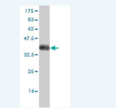 Western Blot: DCAMKL2 Antibody (2A5) [H00166614-M01]