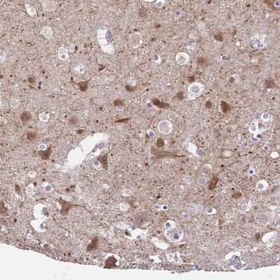 Immunohistochemistry-Paraffin: DCAMKL2 Antibody [NBP1-85282]