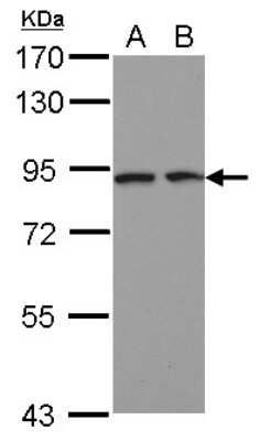 Western Blot: DCBLD2/ESDN Antibody [NBP2-16105]