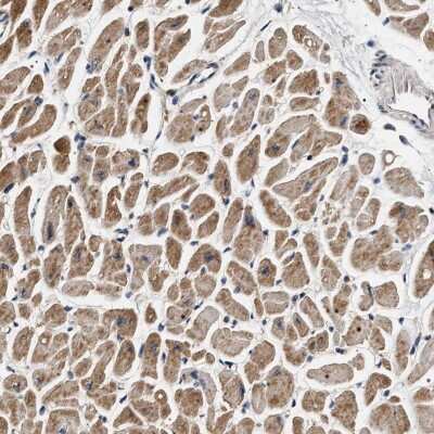 Immunohistochemistry-Paraffin: DCBLD2/ESDN Antibody [NBP1-85582]