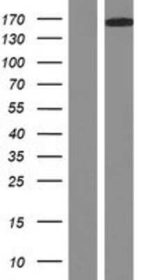 Western Blot: DCC Overexpression Lysate [NBP2-07775]