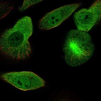 Immunocytochemistry/ Immunofluorescence: DCDC2 Antibody [NBP2-38184]