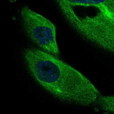 Immunocytochemistry/ Immunofluorescence: DCDC2 Antibody [NBP2-55048]