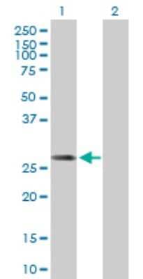 Western Blot: DCI Antibody [H00001632-B01P]
