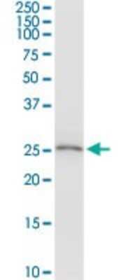 Western Blot: DCI Antibody [H00001632-D01P]