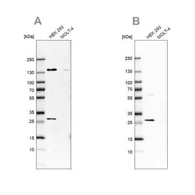 Western Blot: DCI Antibody [NBP1-91821]