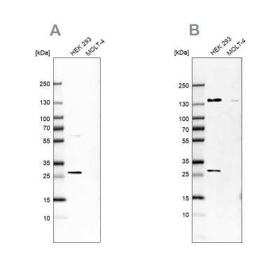 Western Blot: DCI Antibody [NBP1-91822]