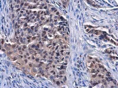 Immunohistochemistry-Paraffin: DCK Antibody (10412) [NBP2-43639]