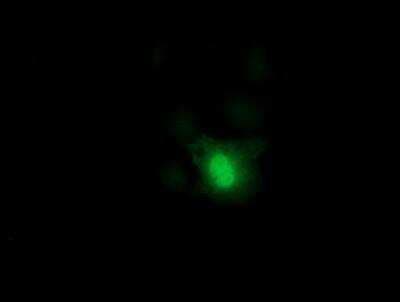 Immunocytochemistry/ Immunofluorescence: DCK Antibody (OTI3F5) [NBP2-00590]