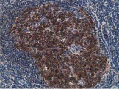 Immunohistochemistry-Paraffin: DCK Antibody (OTI3F5) [NBP2-00590]