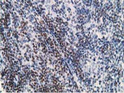Immunohistochemistry-Paraffin: DCK Antibody (OTI3F5) [NBP2-00590]
