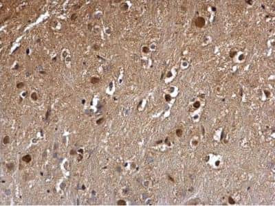 Immunohistochemistry-Paraffin: DCK Antibody [NBP2-16108]