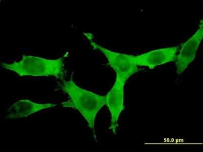 Immunocytochemistry/ Immunofluorescence: DCLK1 Antibody (6H4) [H00009201-M03]