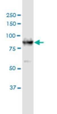Western Blot: DCLK1 Antibody (6H4) [H00009201-M03]