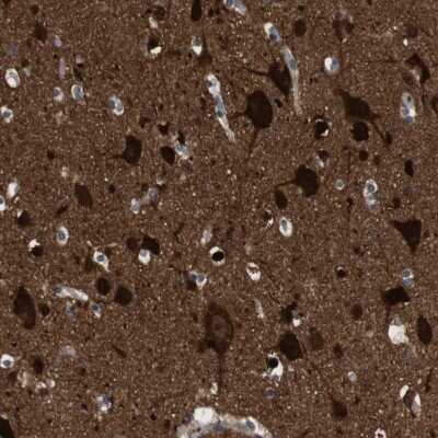 Immunohistochemistry-Paraffin: DCLK1 Antibody [NBP2-48530]