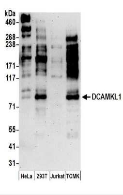 Western Blot: DCLK1 Antibody [NBP2-36420]
