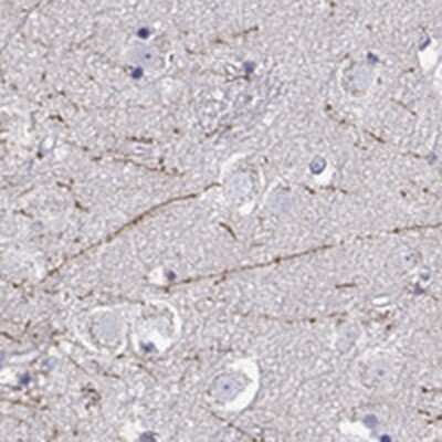 Immunohistochemistry: DCLK3 Antibody [NBP2-68640]