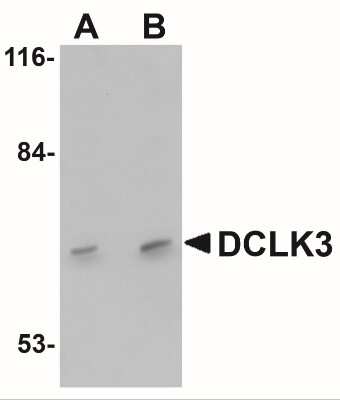 Western Blot: DCLK3 AntibodyBSA Free [NBP1-77129]