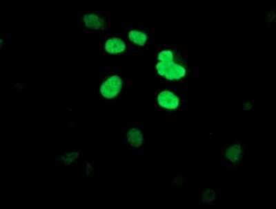 Immunocytochemistry/ Immunofluorescence: DCLRE1B Antibody (OTI2B7) [NBP2-03563]