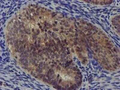 Immunohistochemistry-Paraffin: DCLRE1B Antibody (OTI2B7) [NBP2-03563]