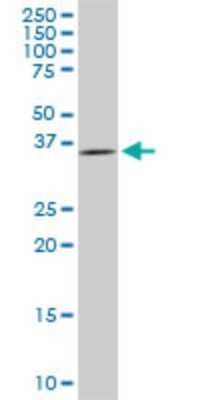 Western Blot: DCPS Antibody (3E5) [H00028960-M03]