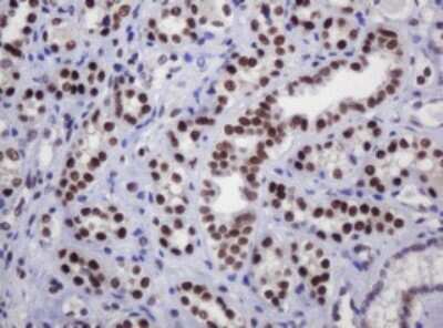 Immunohistochemistry: DCPS Antibody (OTI4H8) [NBP2-45650]