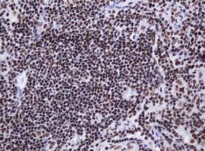 Immunohistochemistry: DCPS Antibody (OTI4H8) [NBP2-45650]