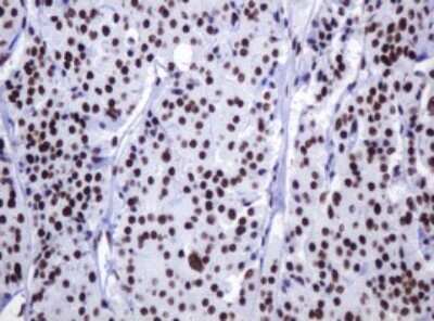 Immunohistochemistry: DCPS Antibody (OTI4H8) [NBP2-45650]