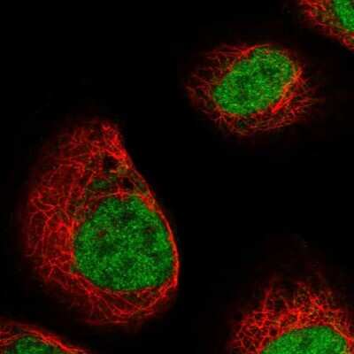 Immunocytochemistry/ Immunofluorescence: DCPS Antibody [NBP1-81749]
