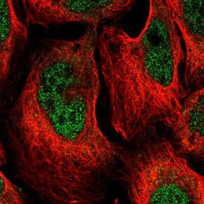 Immunocytochemistry/ Immunofluorescence: DCPS Antibody [NBP2-56249]