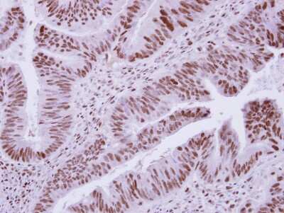 Immunohistochemistry-Paraffin: DCPS Antibody [NBP2-16110]
