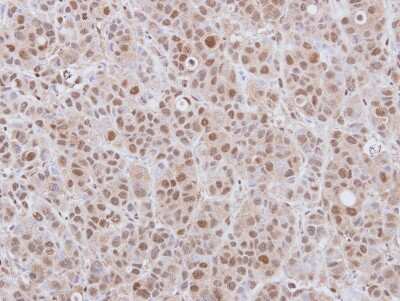 Immunohistochemistry-Paraffin: DCPS Antibody [NBP2-16111]
