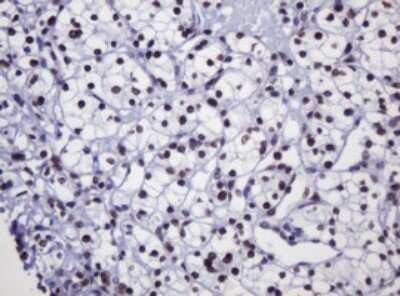 Immunohistochemistry: DCPS Antibody (OTI4H8) - Azide and BSA Free [NBP2-71839]