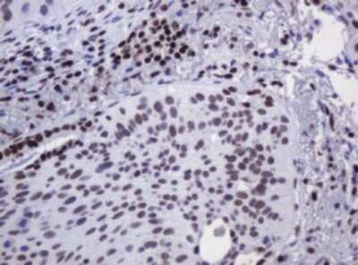Immunohistochemistry: DCPS Antibody (OTI4H8) - Azide and BSA Free [NBP2-71839]