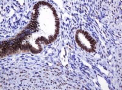Immunohistochemistry: DCPS Antibody (OTI4H8) - Azide and BSA Free [NBP2-71839]