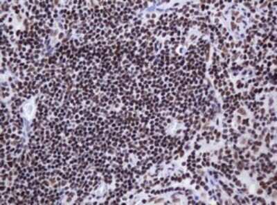 Immunohistochemistry: DCPS Antibody (OTI4H8) - Azide and BSA Free [NBP2-71839]